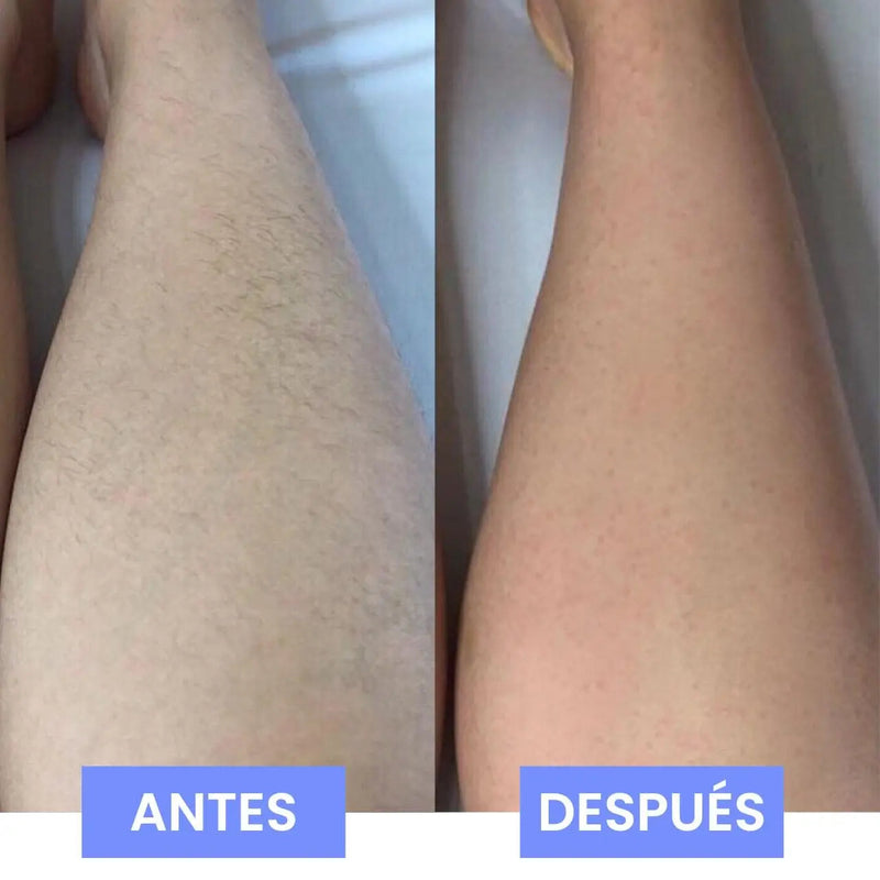 Piedra depilatoria - DbeautyPro [¡Compra 1 y lleva 2!]