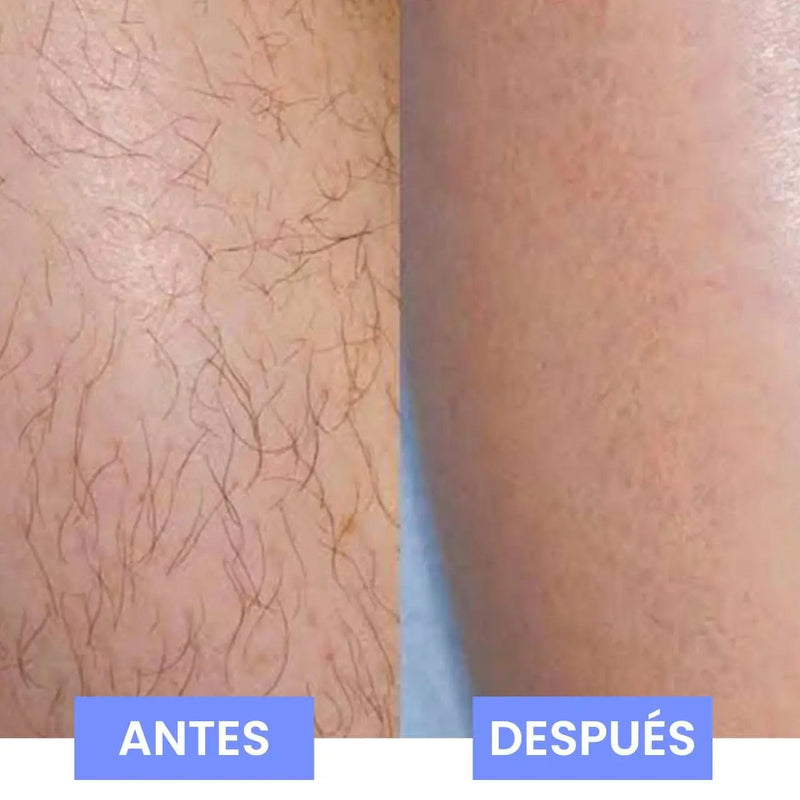 Piedra depilatoria - DbeautyPro [¡Compra 1 y lleva 2!]